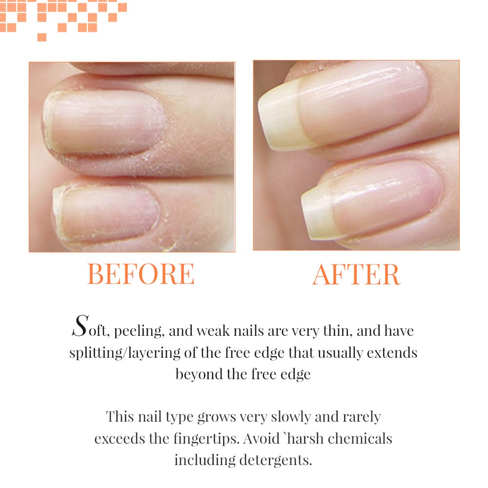 The Natural Nail Experts For Healthy Nail