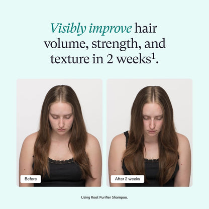 Root Purifier Scalp Microbiome Shampoo