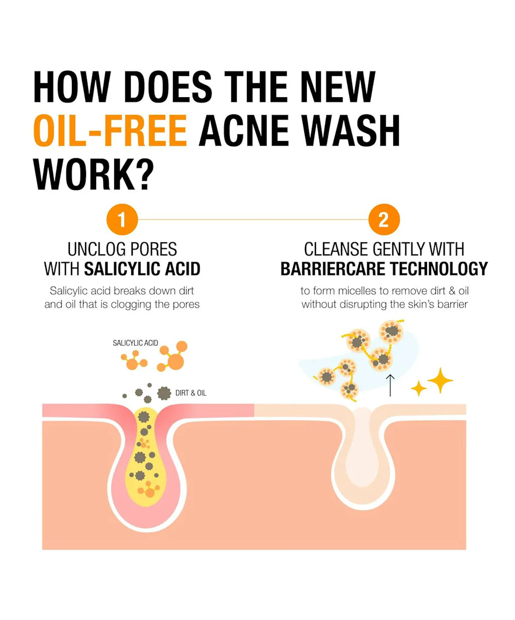 Oil-Free Acne Wash