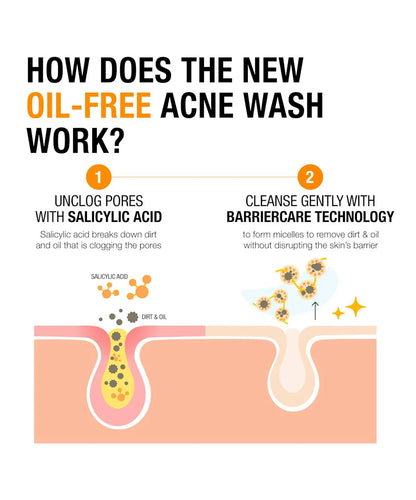 Oil-Free Acne Wash