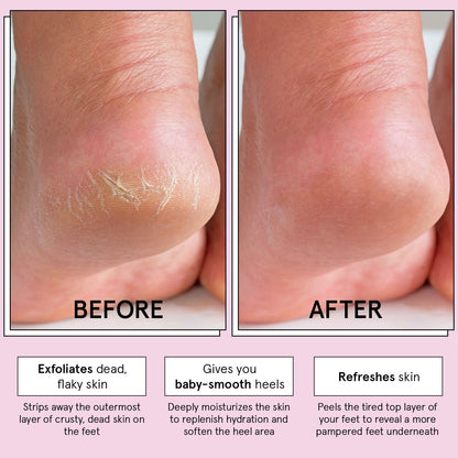 Exfoliating Foot Peel Mask