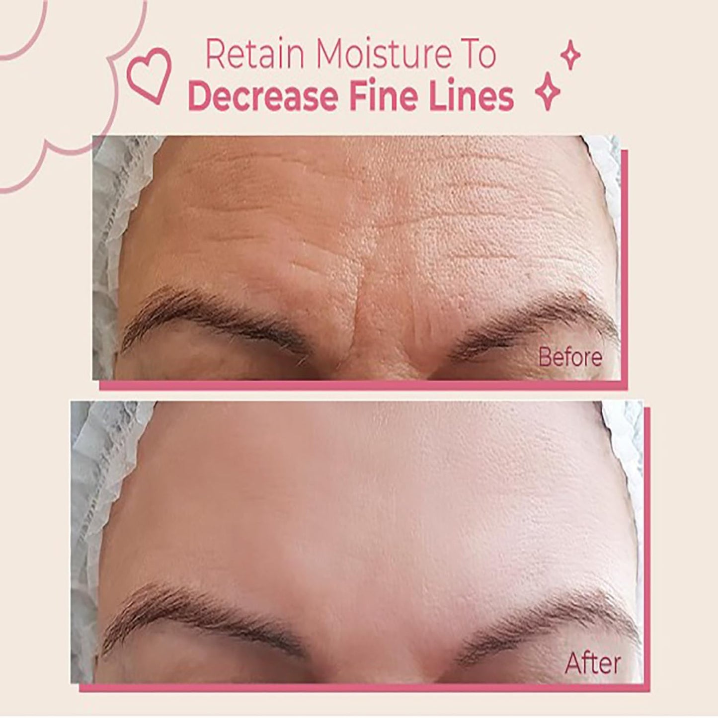 Forehead Wrinkle Patches (2 Pairs)