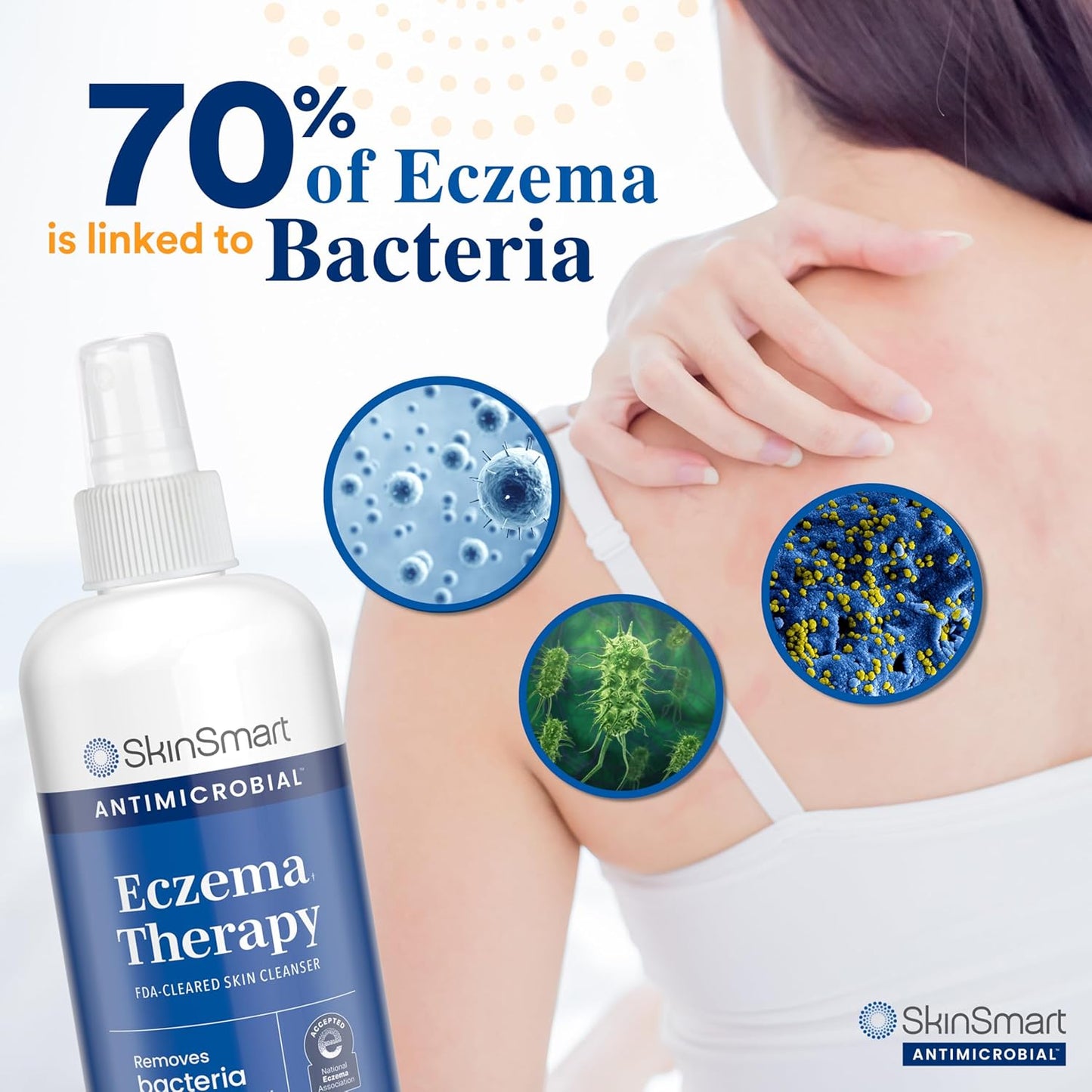 Antimicrobial Eczema Therapy