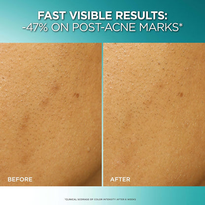 LOREAL Bright Reveal Dark Spot Exfoliant Peel