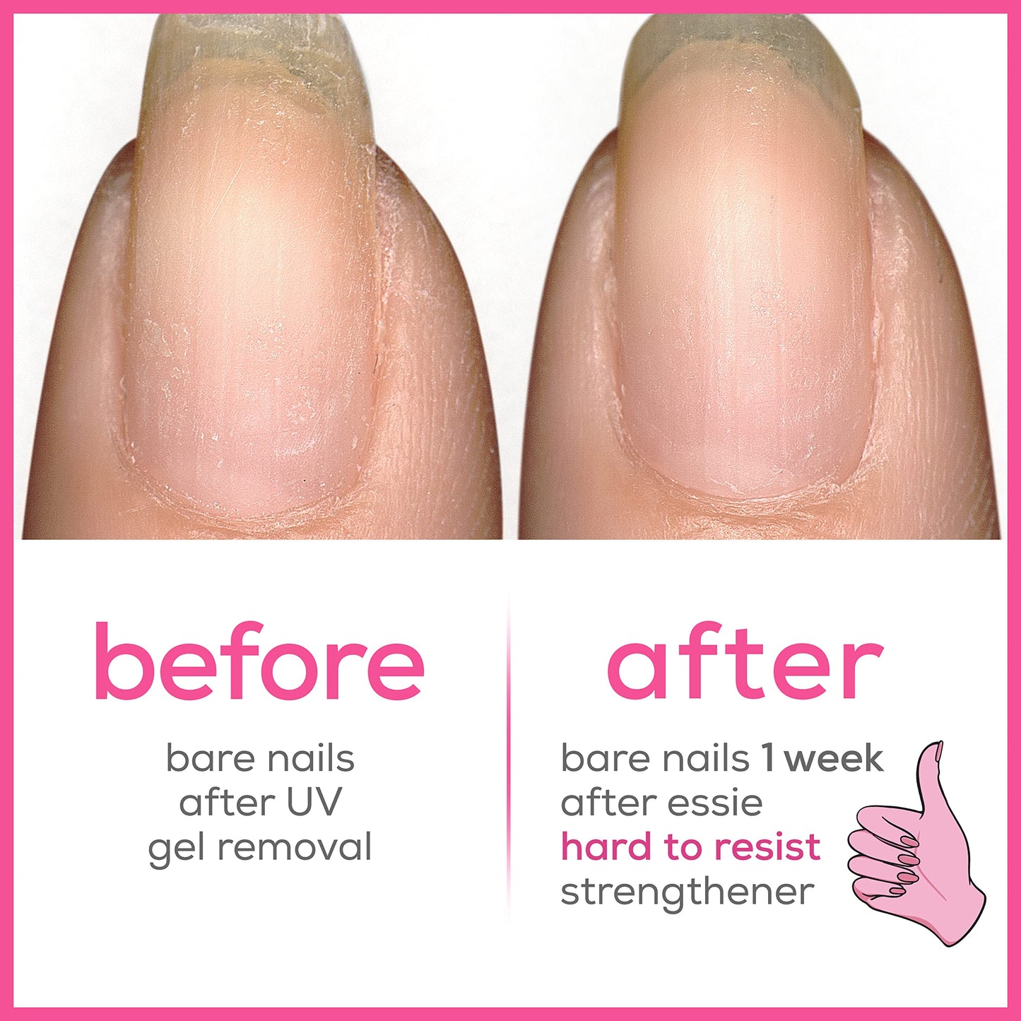 Nail Care - Nail Treatment