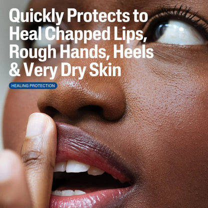 Healing Ointment